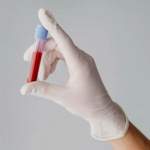 Alanine Aminotransferase (Alt/ Sgpt), Serum