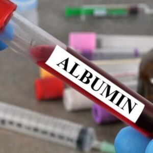 Albumin, Serum