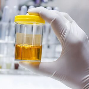 17-Ketosteroids, Urine 24H