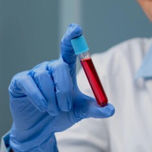 Absolute Eosinophil Count(Aec), Whole Blood