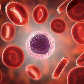 Absolute Lymphocyte Count (Alc), Whole Blood
