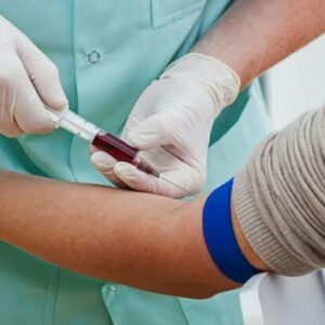 Acetylcholine Receptor Binding Antibody, Serum